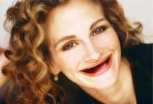 Models actors natural teeth