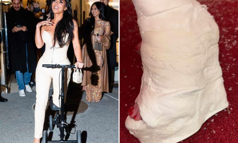 Kim kardashian broken foot scooter