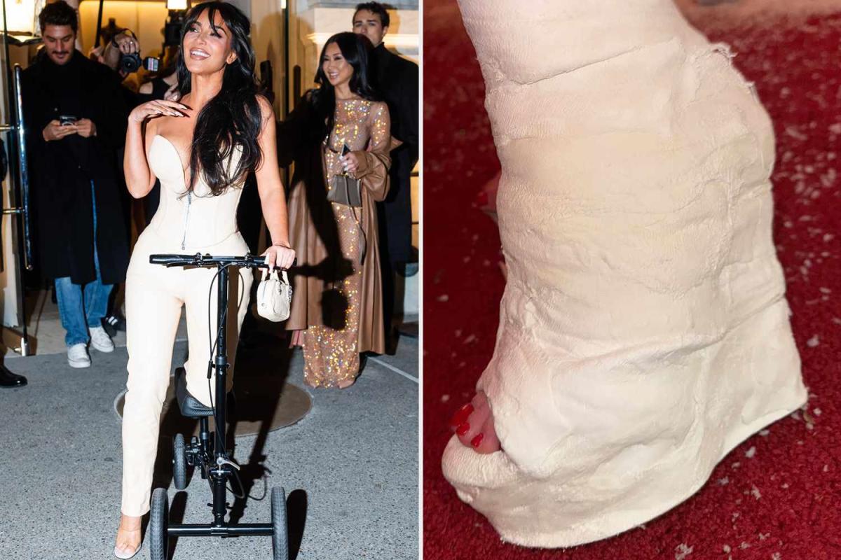 Kim kardashian broken foot scooter