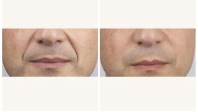 Men are getting filler more than ever