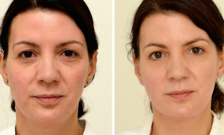 I drank 25 liters of water a day for a week