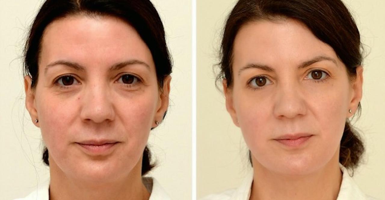 I drank 25 liters of water a day for a week