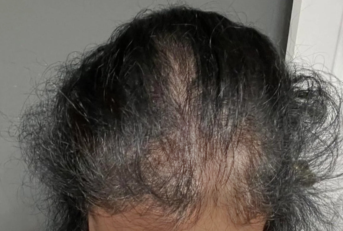 Nara smith rosemary hair growth